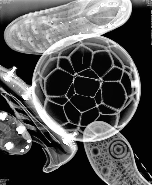 Futebol
