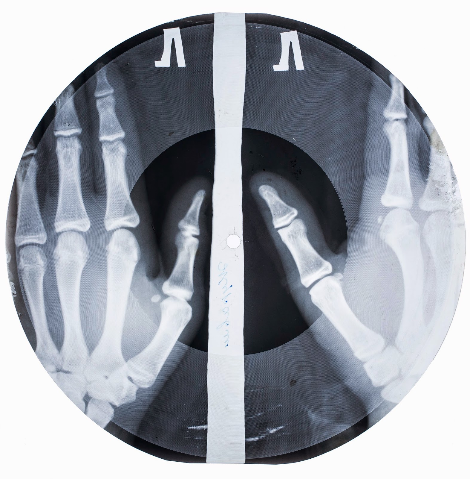An X-Ray record, from Work and Play Behind the Iron Curtain