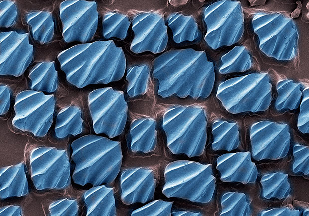 A microscopic view of sharkskin photographed by Robert Clark in Evolution: A Visual Record