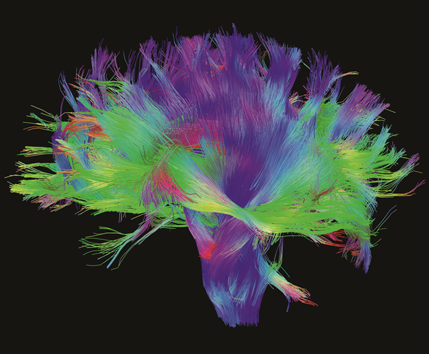 Mapping the Brain, 2014, Human Connectome Project Digital, dimensions variable. Courtesy of the Laboratory of Neuro Imaging and Martinos Center for Biomedical Imaging, Consortium of the Human Connectome Project. From Map