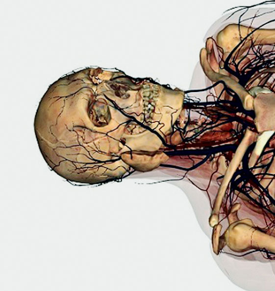 Detail from Anatomage Table, 2016 by Anatomage