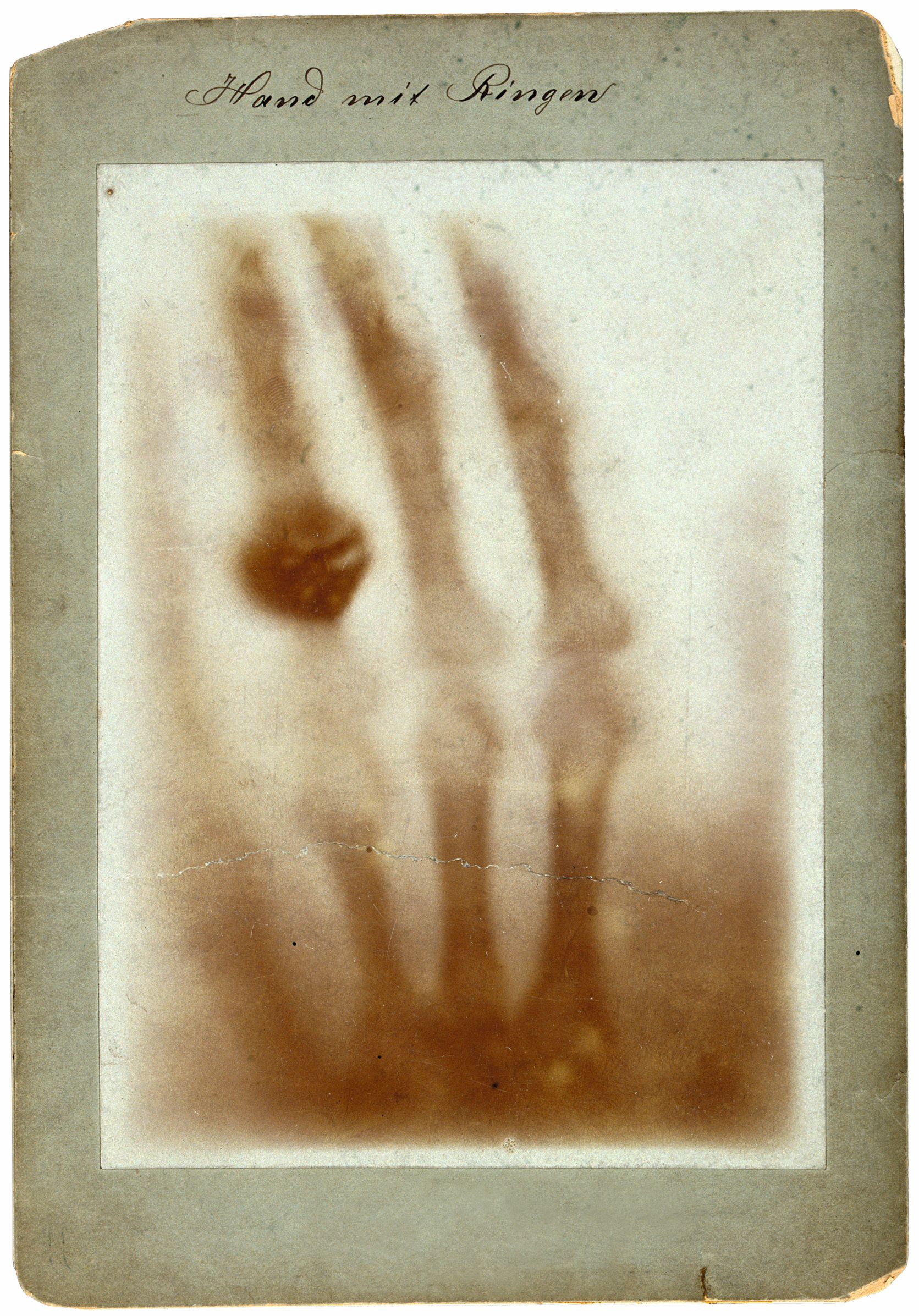 Hand with Rings, 1895, by Wilhelm Conrad Röntgen. As reproduced in Anatomy: Exploring the Human Body