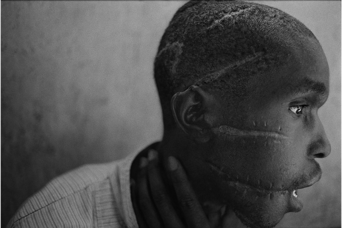 Survivor of Hutu death camp, Rwanda, 1994. Photograph by James Nachtwey