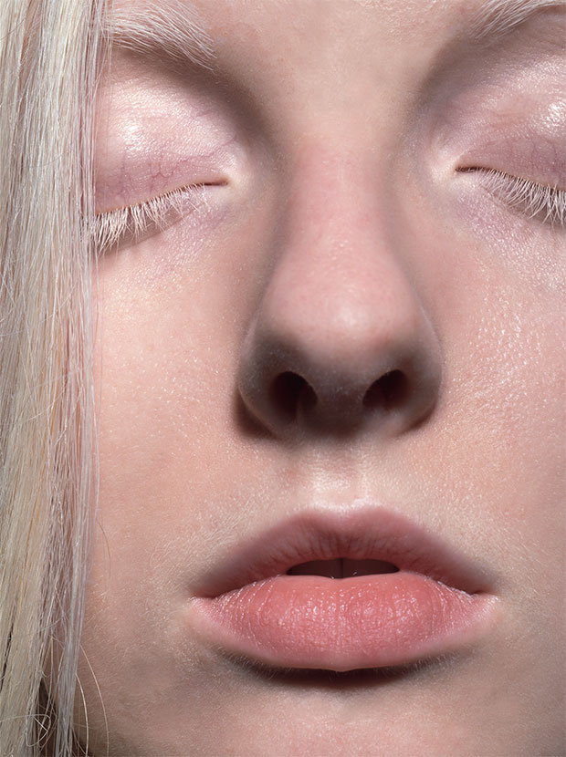 An albino person, as photographed by Robert Clark. Reproduced in Evolution: A Visual Record