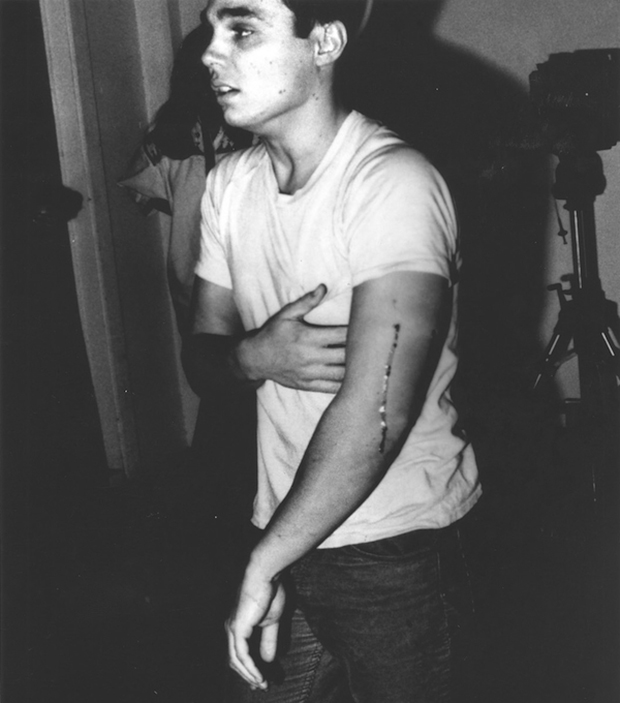 Chris Burden immediately after peforming Shoot, 1971